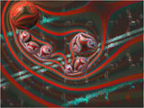 Space Balls
